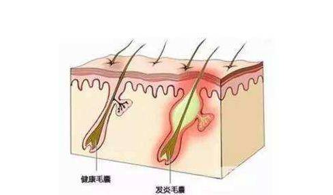 发型头发塌显脸大，石原里美IU都中招，这些方法拯救你！