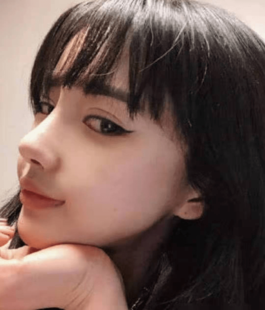 如何判断一个人是不是整容脸主要取决以下几方面你有吗