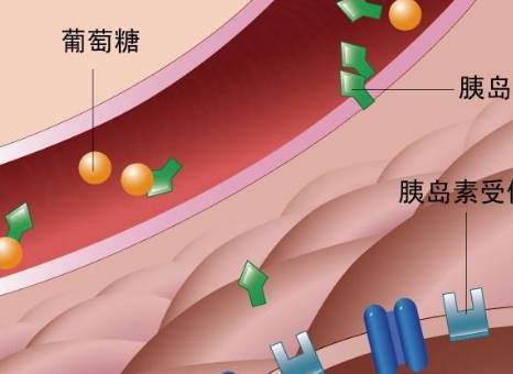 并发症|你的糖尿病是轻还是重？教你一个判断糖尿病轻重程度的方法！