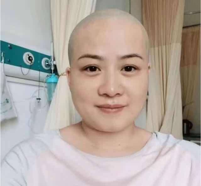 性情大变|岳云鹏大女儿近照曝光，与爸爸高度撞脸，妈妈生病后性情大变