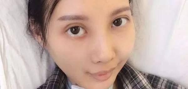 这位29岁的香港女演员七年的抗癌运动已经不多了:考虑整容手术