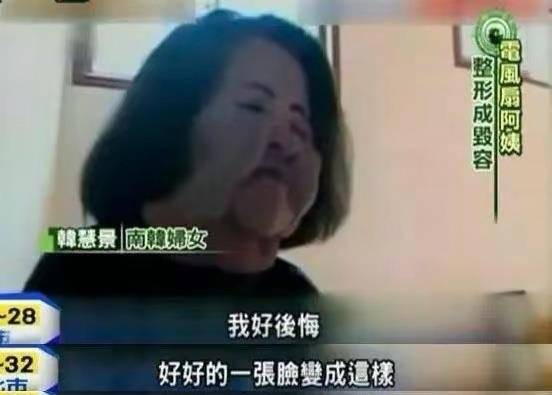 因为10位整容毁掉的女星：有人自己注射食用油，有人上瘾，有人丢了命