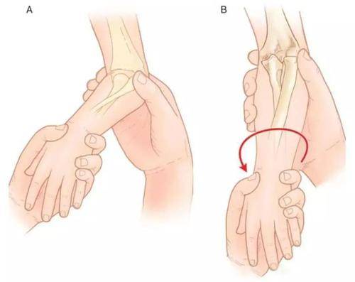小儿手脱臼怎么办