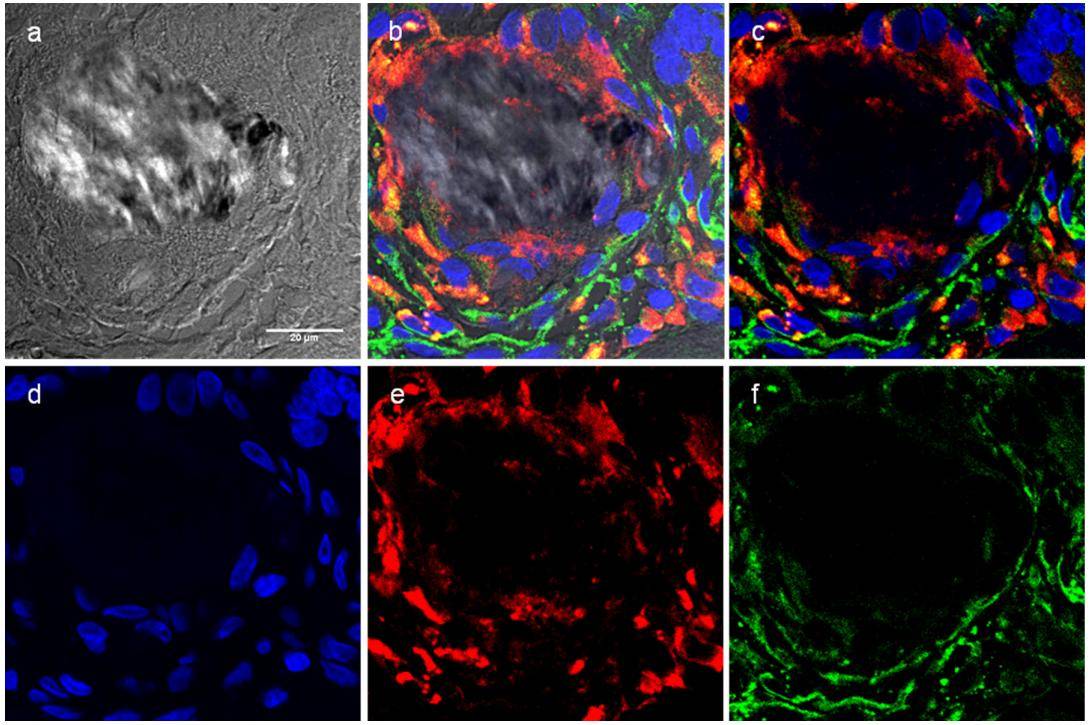 艾维岚|“活性诱导”助“丽”爱美人士年轻态