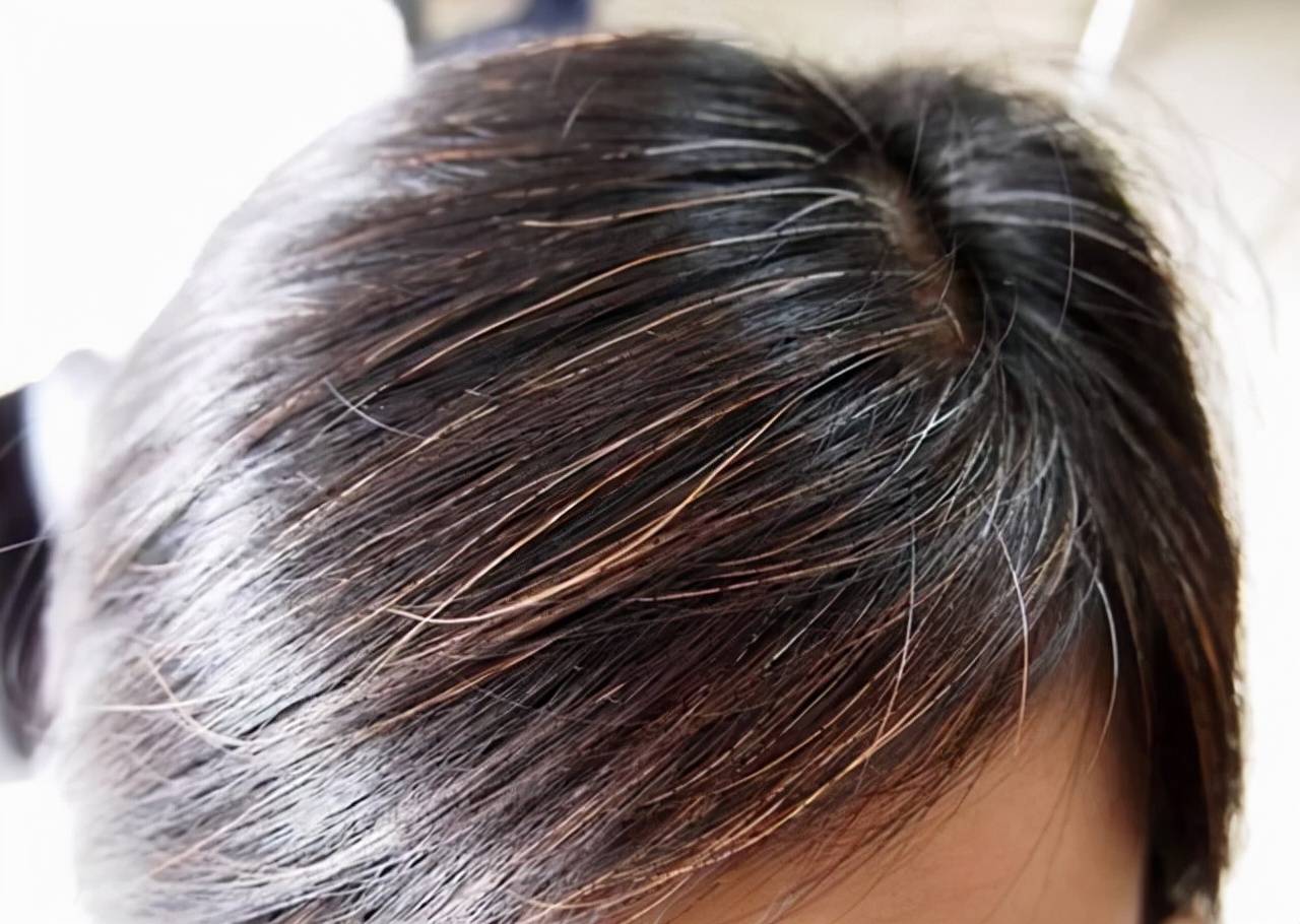 怎样保养头发不掉不白 580be52f2b944446bb9eafb9c76debc7.jpeg