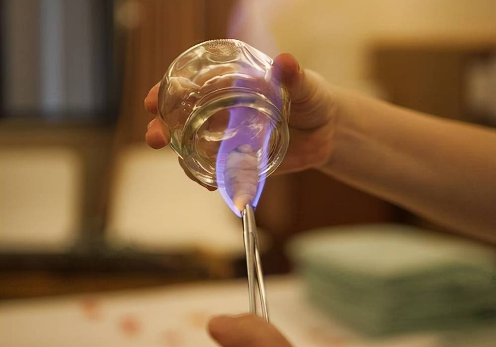 拔罐为什么疼痛 c915f8187cac4f08a4d67e1f996fe5ab.jpeg