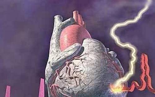 心脏|高血压是如何一步步“压垮”心脏的？有必要采取这7个措施！