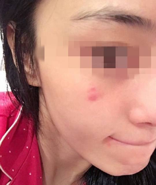 化妆品美女用代购化妆品被毁容，前男友来安慰却被发现大秘密