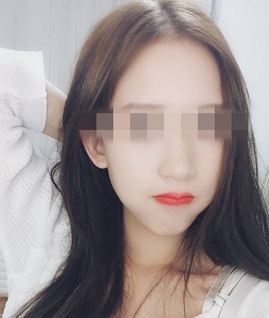 化妆品美女用代购化妆品被毁容，前男友来安慰却被发现大秘密