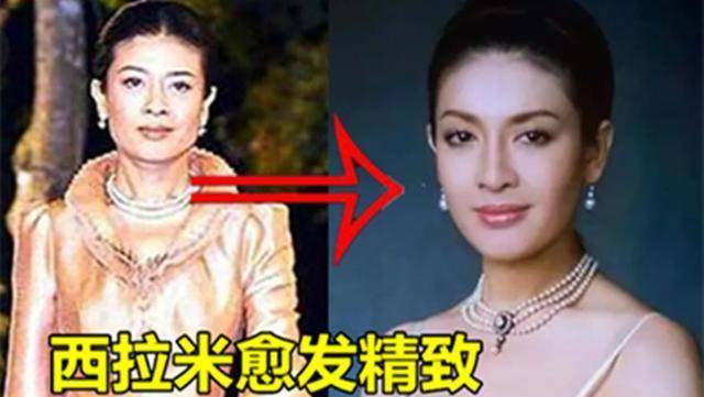 进行西拉米也是人造美人，接受微调改善“朝天鼻”，模仿诗丽吉做厚唇