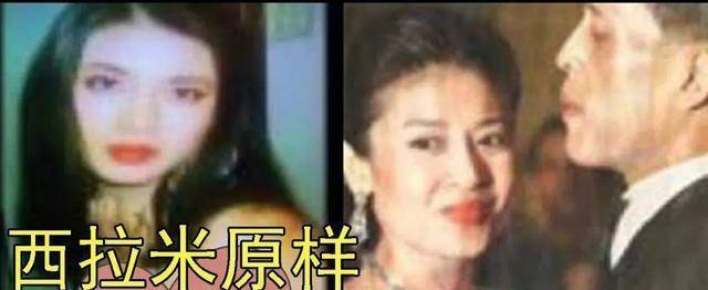 进行西拉米也是人造美人，接受微调改善“朝天鼻”，模仿诗丽吉做厚唇
