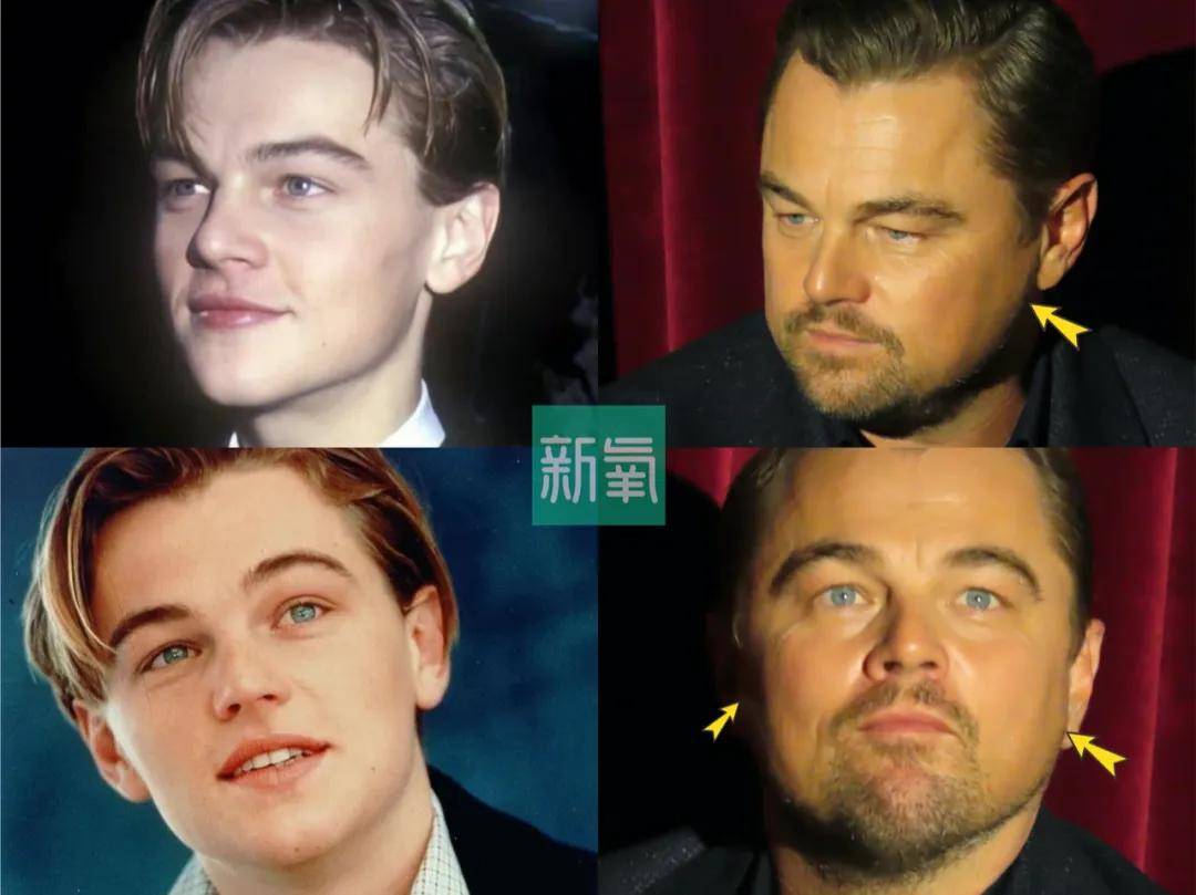 八大处甜茶：别问，问就是发腮了...