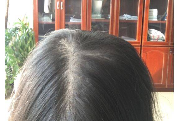卷发女生头顶头发稀少怎么办？女生头顶头发稀少怎么扎发看？