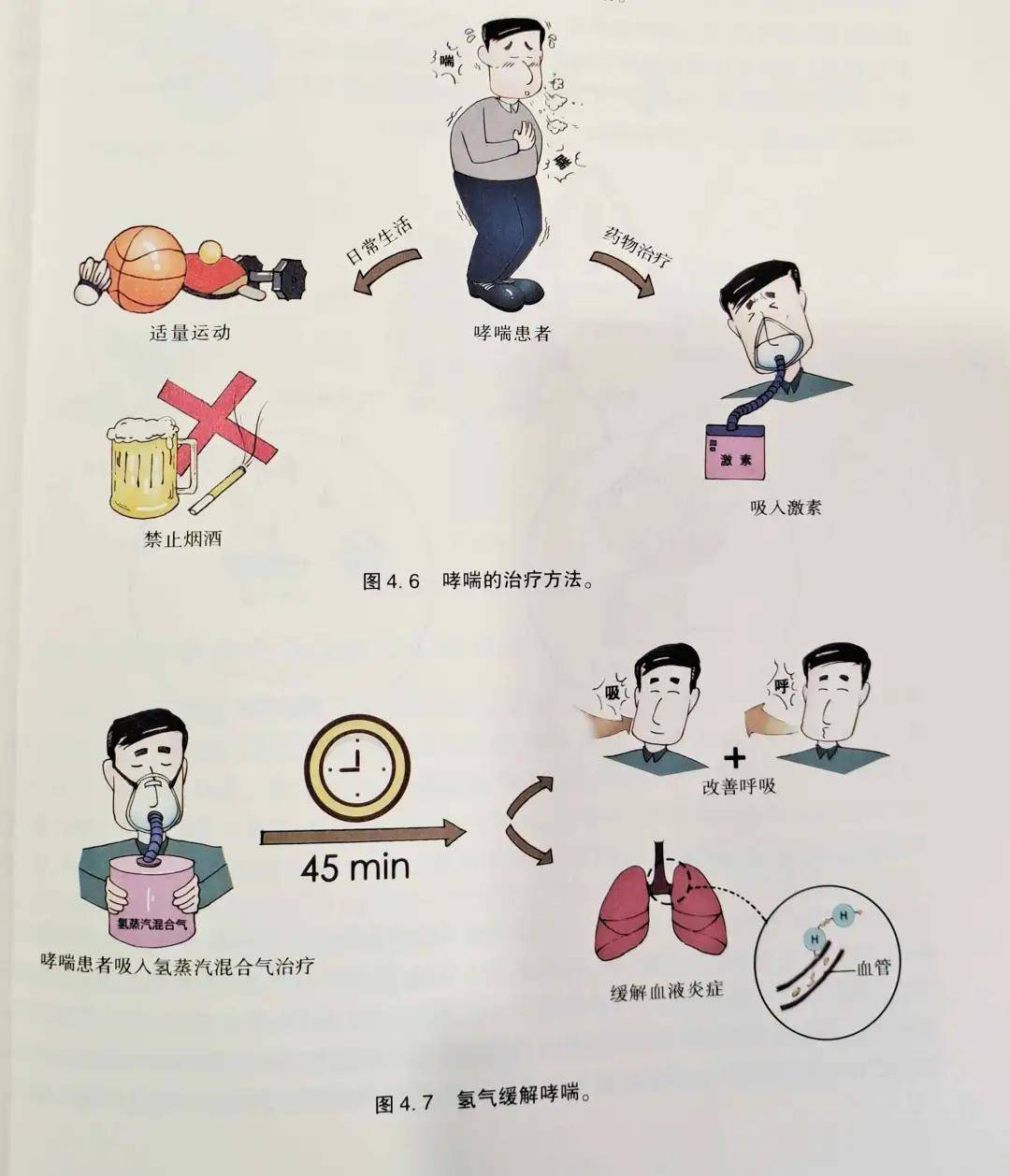 探討了吸入氫氣對哮喘和慢性阻塞性肺疾病(copd)患者氣道炎症的影響