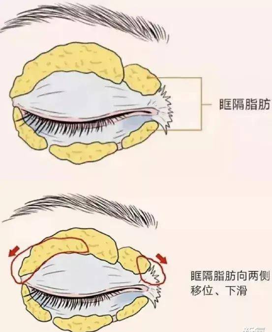 眉骨患11天痊愈后的Lisa，怎么完全认不出了…