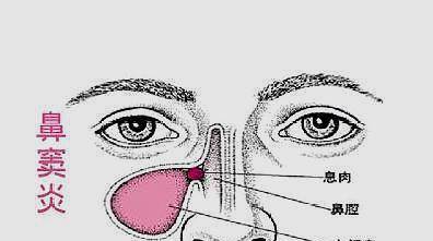 b3a227f7cebe452586364a37abef7fc6.jpeg