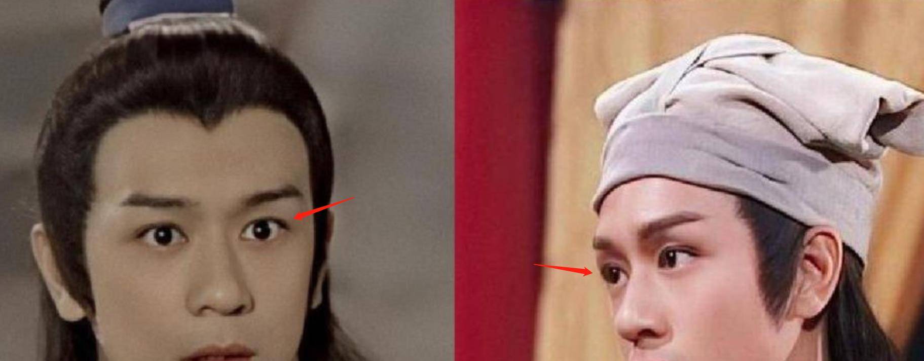 下巴明星频翻车医美需谨慎!有人脸变充气气球,有人下巴变天气预报