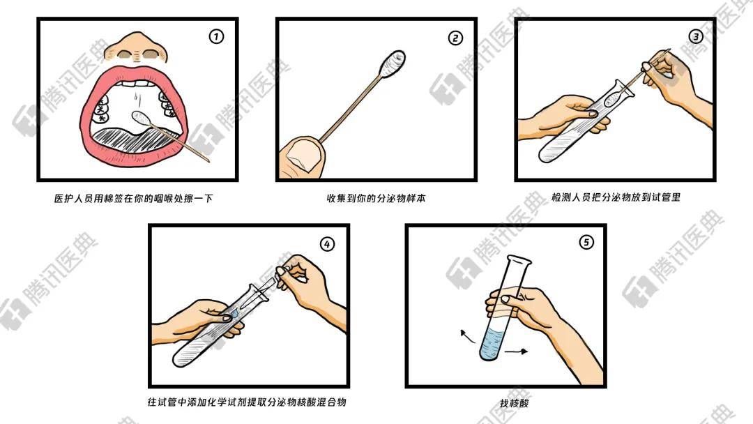 捅嗓子棉签图片