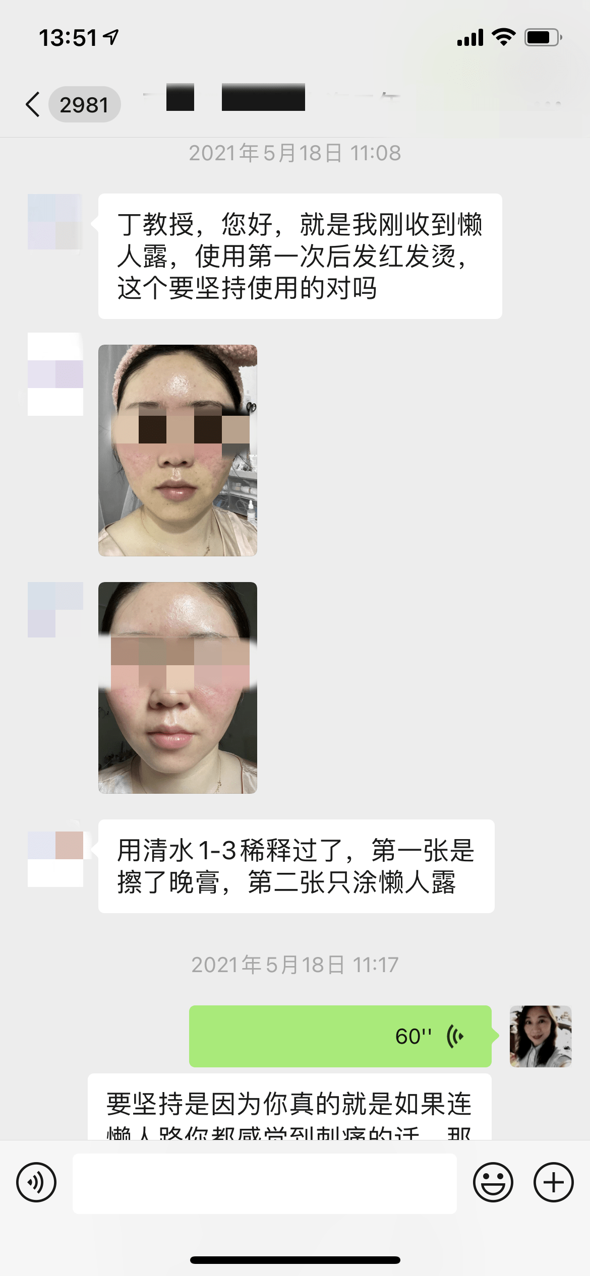 脸部玫瑰痤疮（红血丝、激素脸）— 终于可以和你说再见