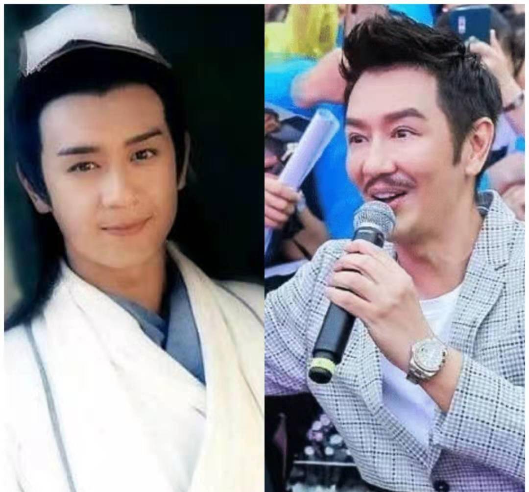 下巴你以为只有女明星酷爱整容？其实男明星整容更疯狂