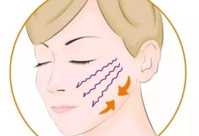 什么科普篇：ppdo线雕是什么线？ppdo线雕维持时间？