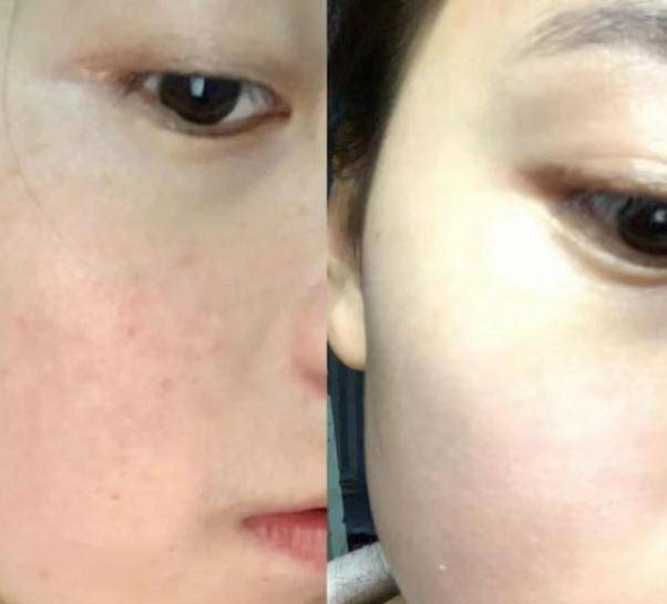 皮肤为何“不建议”女人常用粉底液？有“2个”原因，现在知道还不晚