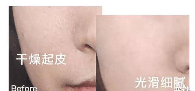 品牌继注射“玻酸”后，又一“抗衰老”方式走红，即安全还方便