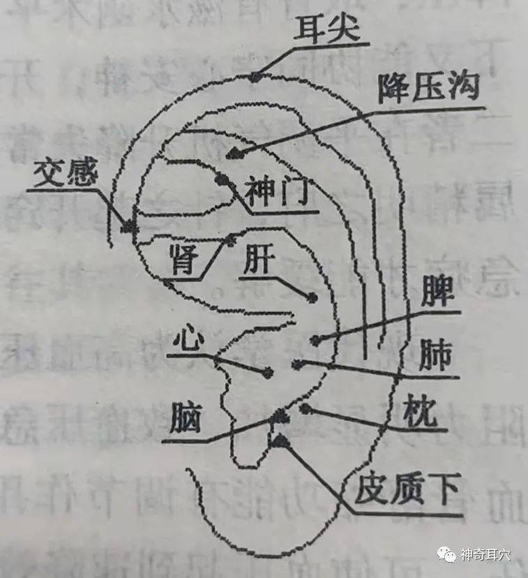 益康耳穴高血压危象的症状有哪些如何防治才是关键