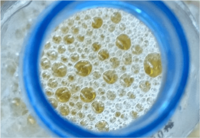 可能是体内尿酸值已超过"警戒线",尿酸值超标,形成尿酸盐结晶,还可能