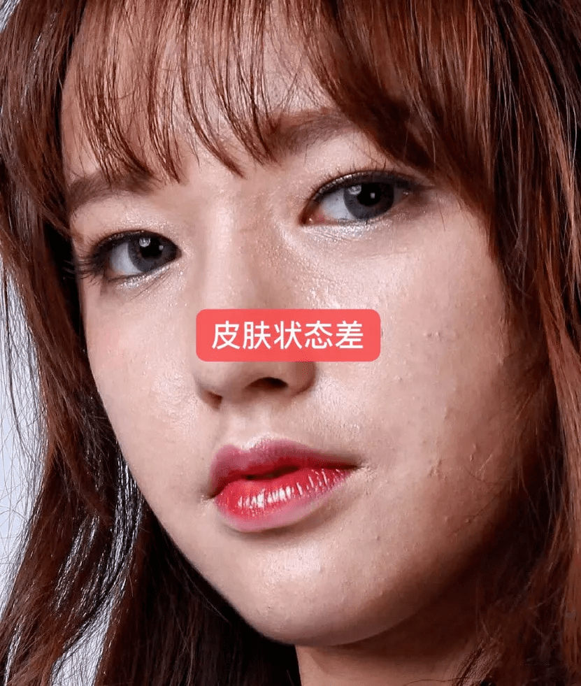 高清生浮粉、长痘、整容痕迹，明星未修图里的脸，让我看见了人间真实