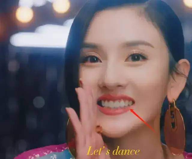 脸部明星整牙后遗症：杨幂脸部松弛，王嘉尔颧骨外扩，宋祖儿法令纹深