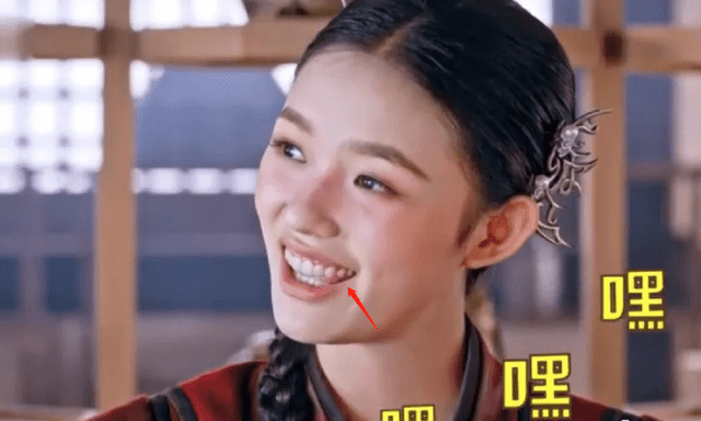 脸部明星整牙后遗症：杨幂脸部松弛，王嘉尔颧骨外扩，宋祖儿法令纹深