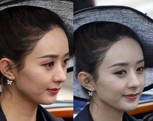 滑铁卢离开了精修图，那些颜值滑铁卢的女明星