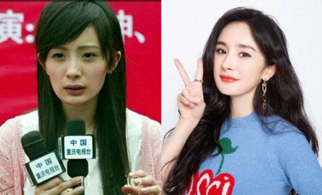 因为看脸是美女，头发一撩全完蛋！这些女星被发际线拖累，个个铁刘海