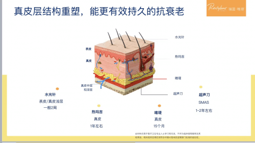 真皮双孖医疗王培蕾|瑞蓝唯瑅高端在哪？台州艺星和南京美莱专场
