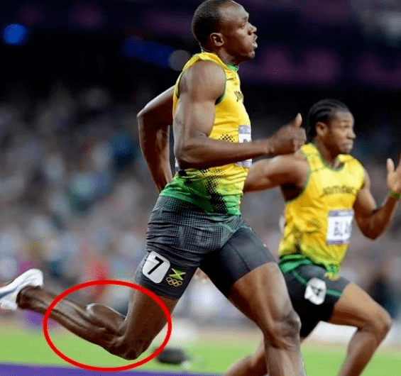 博尔特的跟腱可是有纪录的最长存在,那是长达42cm.