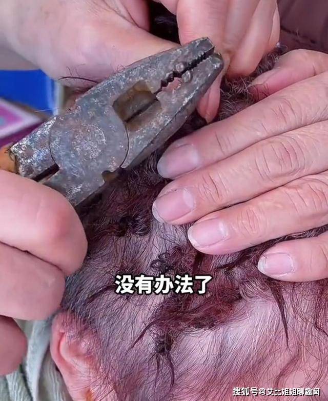 小号大妈发量太少，用超小号发卡烫头，结果发卡拿不下来只得上钳子