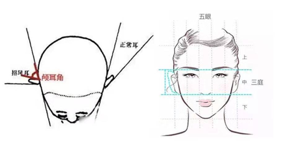 颅骨精灵耳整形真的符合审美吗？怎样才是合格的耳朵？