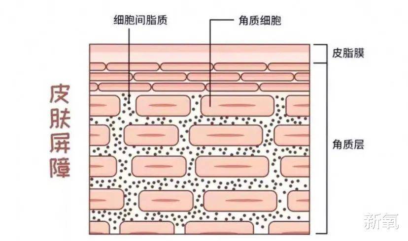 血管比姨妈来得还准的春季综合症,烂脸还算是轻微的?