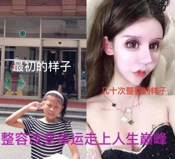 审美观记得3年整容60次“网红女孩”吗？网友盼着她脸垮，现在她来了