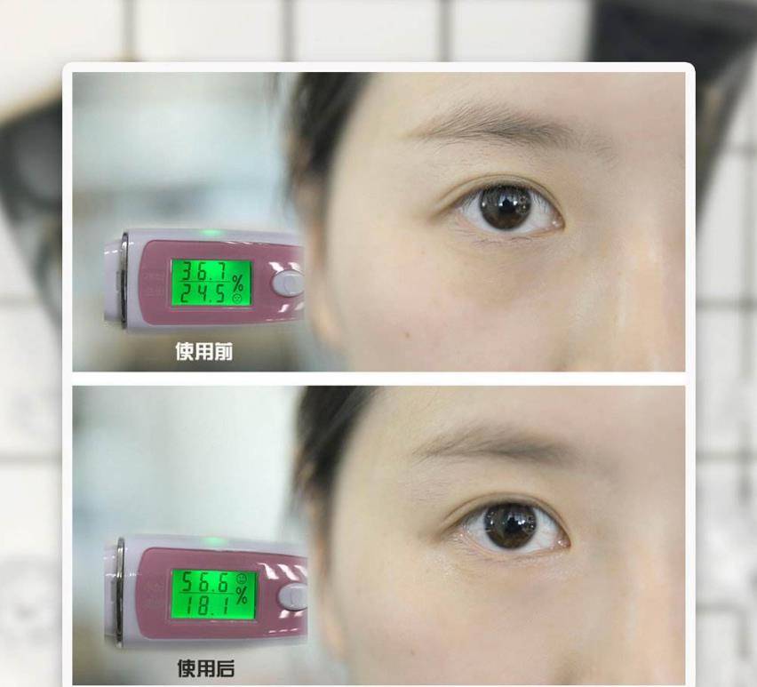 戚薇36岁佟丽娅老成这样?黑眼袋严重吓坏众人,粉丝:丫丫擦下眼霜吧