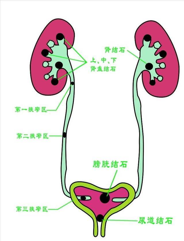 左肾输尿管图片