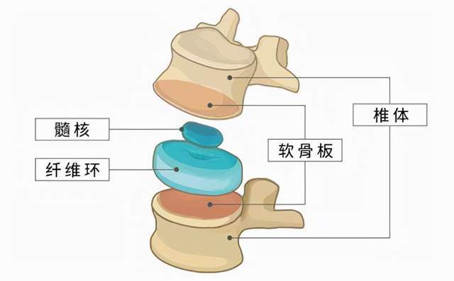 腰椎间盘的结构由三类组成:纤维环,髓核,软骨板,如下图