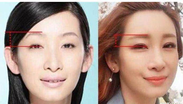 单眼皮内娱最假双眼皮PK，就差割到脑门了，生怕别人看不出是割的？