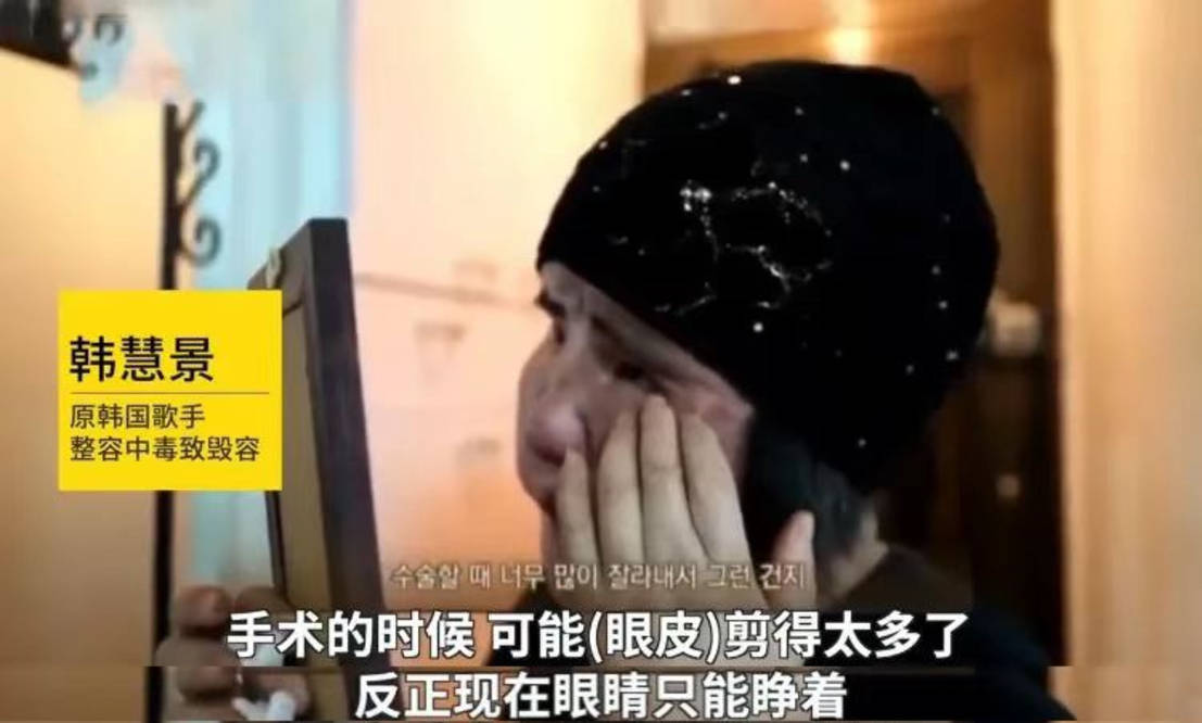 因为女星韩慧景：为了更漂亮，给脸注射食用油，把脸整成“猪头”