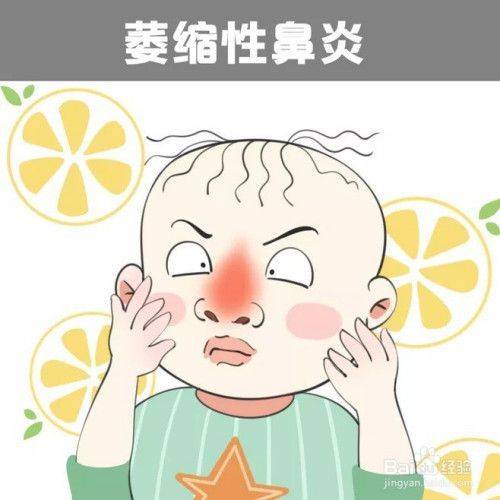 萎缩性鼻炎又称为臭鼻症你知道吗