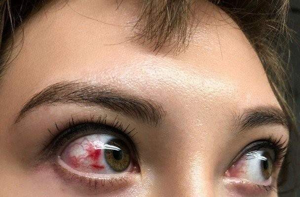 她被子弹击中之后,眼部的血管爆裂流血,看上去红彤彤的一片特别恐怖.