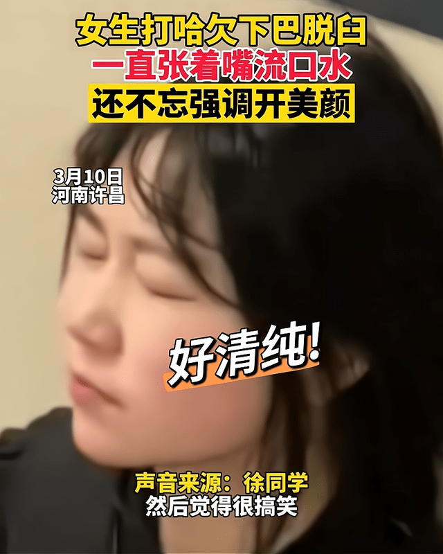 下巴女生打哈欠下巴脱臼，张着嘴流口水不忘美颜，网友赞小姐姐真清纯