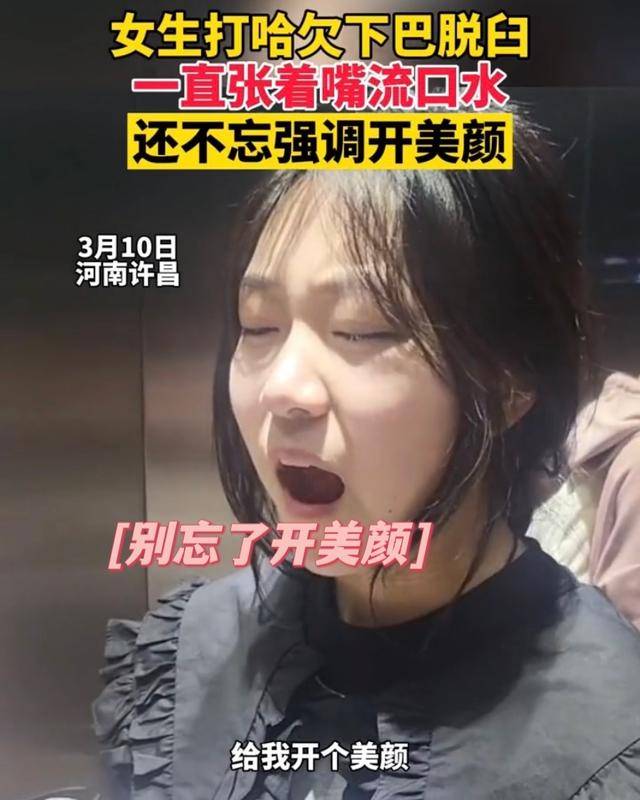 下巴女生打哈欠下巴脱臼，张着嘴流口水不忘美颜，网友赞小姐姐真清纯