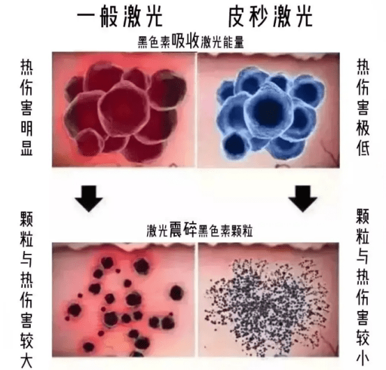 效应不要斑斑点点，爱美女孩白嫩肌肤的秘诀